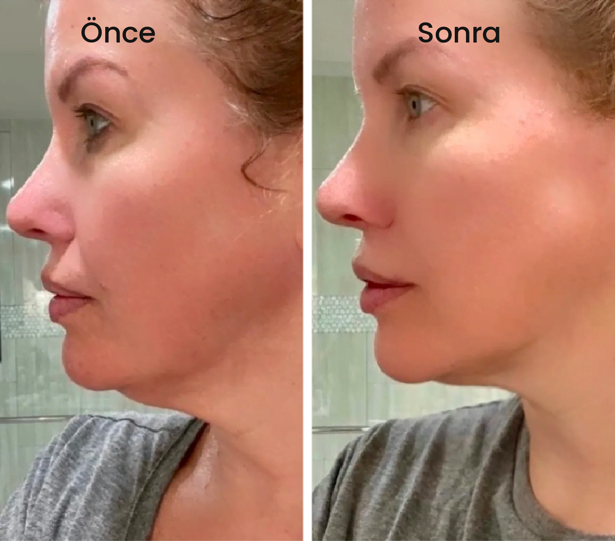 LENFATİK YÜZ FIRÇASI + HEDİYE SIMPLE KREM SETİ