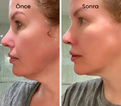 LENFATİK YÜZ FIRÇASI + HEDİYE SIMPLE KREM SETİ